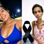 Cancer-Stricken Emily’s Painful Account: The Underestimated Peril of Smoking
