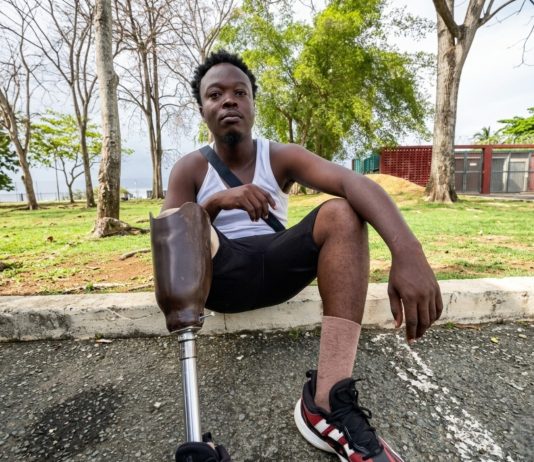 Tobago amputee says he survived on beach for two years.