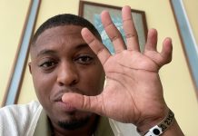 I Have 11 Fingers’ – Kess Ramsey Embraces What Makes Him Unique