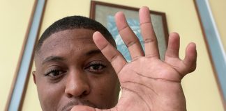 I Have 11 Fingers’ – Kess Ramsey Embraces What Makes Him Unique