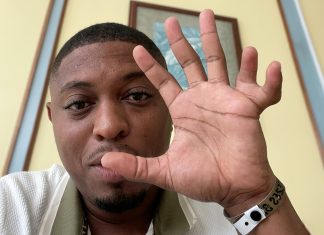 I Have 11 Fingers’ – Kess Ramsey Embraces What Makes Him Unique