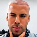 Trinidad TikToker Takes Followers Inside His Hair Transplant: ‘Most Expensive Haircut’