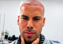 Trinidad TikToker Takes Followers Inside His Hair Transplant: ‘Most Expensive Haircut’