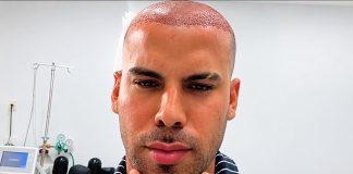 Trinidad TikToker Takes Followers Inside His Hair Transplant: ‘Most Expensive Haircut’