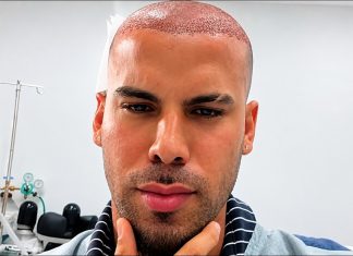 Trinidad TikToker Takes Followers Inside His Hair Transplant: ‘Most Expensive Haircut’
