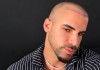 Alex Bebert Shares Day 5 Hair Transplant Update