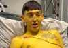 Cheshire Man’s Skin Turns Yellow Before Life-Saving Liver Transplant