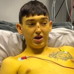 Cheshire Man’s Skin Turns Yellow Before Life-Saving Liver Transplant
