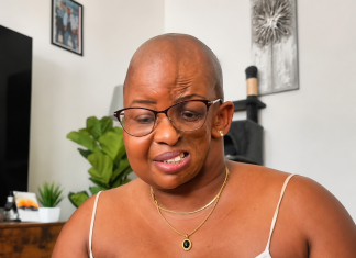 Teacher Called My Facial Condition ‘Witchcraft,’ Woman Recalls Painful Childhood Experience