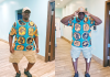Grand Bahama Man’s $100k Surgery Transforms Life After Decades of Pain and Ridicule