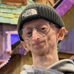 Influencer Michiel Vandeweert Passes at 28, Inspires Millions with Progeria Journey