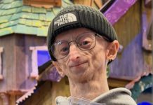 Influencer Michiel Vandeweert Passes at 28, Inspires Millions with Progeria Journey