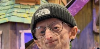 Influencer Michiel Vandeweert Passes at 28, Inspires Millions with Progeria Journey