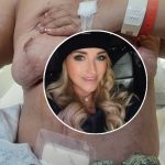 Woman alleges cosmetic surgery led to devastating complications