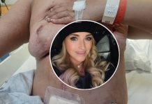 Woman alleges cosmetic surgery led to devastating complications