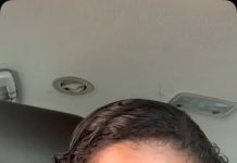 Jessie’s Inspiring Journey: Living Life After Assault with Herpes