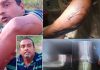 Trinidad Man Alleges Police Threats, Seeks Action After Year-Long Wait Post-Injury