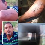 Trinidad Man Alleges Police Threats, Seeks Action After Year-Long Wait Post-Injury