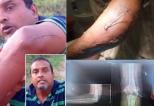 Trinidad Man Alleges Police Threats, Seeks Action After Year-Long Wait Post-Injury