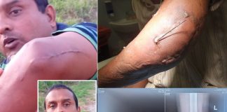 Trinidad Man Alleges Police Threats, Seeks Action After Year-Long Wait Post-Injury