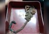 Scorpion Sting Hospitalises Man Sleeping in Trinidad’s Northern Range